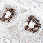 Immunohistochemical staining of human testis shows high expression.