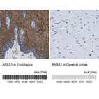 Anti-ANXA1 Antibody