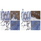 Immunohistochemical staining of human colon, esophagus, lung and lymph node using Anti-ANXA1 antibody HPA011271 (A) shows similar protein distribution across tissues to independent antibody HPA011272 (B).