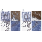 Immunohistochemical staining of human colon, esophagus, lung and lymph node using Anti-ANXA1 antibody HPA011271 (A) shows similar protein distribution across tissues to independent antibody HPA011272 (B).