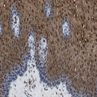 Immunohistochemical staining of human esophagus shows moderate to strong positivity in squamous epithelial cells.