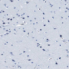 Immunohistochemical staining of human cerebral cortex shows no positivity in neurons as expected.