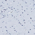 Immunohistochemical staining of human cerebral cortex shows no positivity in neurons as expected.