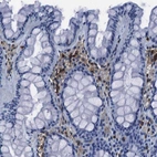 Immunohistochemical staining of human colon shows moderate positivity in lymphoid cells.