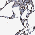 Immunohistochemical staining of human lung shows strong positivity in macrophages.