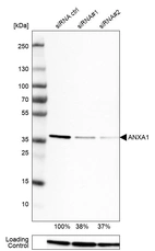Western blot analysis in U-251MG cells transfected with control siRNA, target specific siRNA probe #1 and #2, using Anti-ANXA1 antibody. Remaining relative intensity is presented. Loading control: Anti-PPIB.