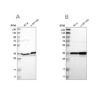 Western blot analysis using Anti-ANXA1 antibody HPA011271 (A) shows similar pattern to independent antibody HPA011272 (B).