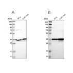 Western blot analysis using Anti-ANXA1 antibody HPA011271 (A) shows similar pattern to independent antibody HPA011272 (B).