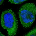 Immunofluorescent staining of human cell line A-431 shows localization to nucleoplasm, plasma membrane & cytosol.