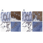 Immunohistochemical staining of human colon, esophagus, lung and lymph node using Anti-ANXA1 antibody HPA011272 (A) shows similar protein distribution across tissues to independent antibody HPA011271 (B).