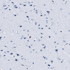 Immunohistochemical staining of human cerebral cortex shows no positivity in neurons as expected.