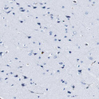 Anti-ANXA1 Antibody