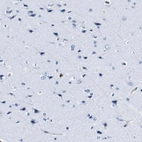 Immunohistochemical staining of human cerebral cortex shows no positivity in neurons as expected.