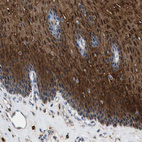 Immunohistochemical staining of human esophagus shows strong positivity in squamous epithelial cells.