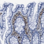 Immunohistochemical staining of human colon shows strong positivity in lymphoid cells.