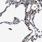 Immunohistochemical staining of human lung shows strong positivity in macrophages.