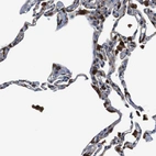 Immunohistochemical staining of human lung shows strong positivity in macrophages.
