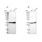 Western blot analysis using Anti-ANXA1 antibody HPA011272 (A) shows similar pattern to independent antibody HPA011271 (B).
