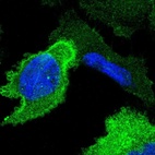 Immunofluorescent staining of human cell line U-251 MG shows localization to plasma membrane & cytosol.