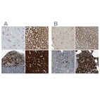 Anti-SSR1 Antibody