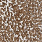 Immunohistochemical staining of human liver shows moderate granular cytoplasmic positivity in hepatocytes.