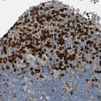 Anti-SSR1 Antibody