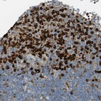 Immunohistochemical staining of human lymph node shows strong cytoplasmic positivity in non-germinal center cells.