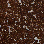 Anti-SSR1 Antibody