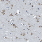 Immunohistochemical staining of human cerebral cortex shows moderate granular cytoplasmic positivity in neurons.