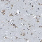 Immunohistochemical staining of human cerebral cortex shows moderate granular cytoplasmic positivity in neurons.
