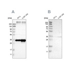 Anti-SSR1 Antibody