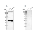 Western blot analysis using Anti-SSR1 antibody HPA011276 (A) shows similar pattern to independent antibody HPA017062 (B).