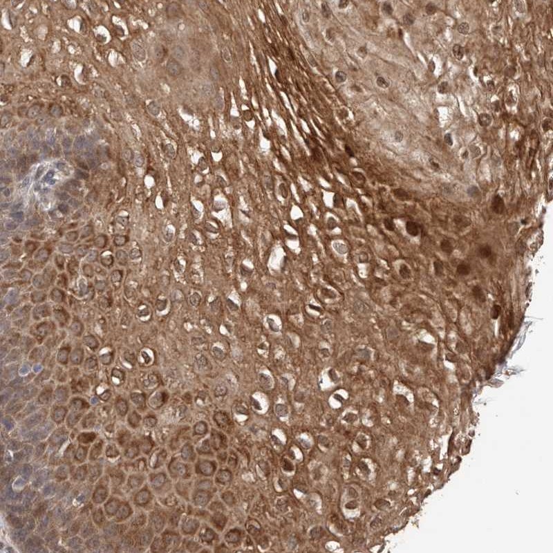 Anti-TEX13B Antibody
