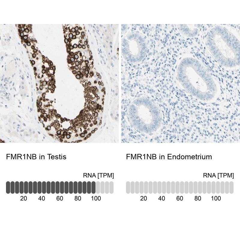 Anti-FMR1NB Antibody