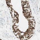 Immunohistochemical staining of human testis shows high expression.