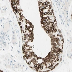 Immunohistochemical staining of human testis shows high expression.