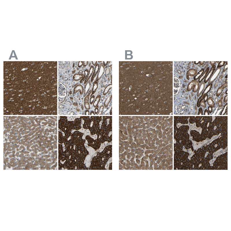 Anti-C1GALT1 Antibody
