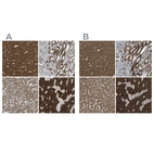 Anti-C1GALT1 Antibody