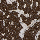 Immunohistochemical staining of human parathyroid gland shows strong cytoplasmic positivity in glandular cells.