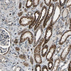 Immunohistochemical staining of human kidney shows moderate to strong cytoplasmic positivity in cells in tubules.