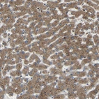 Immunohistochemical staining of human liver shows moderate cytoplasmic positivity in hepatocytes.