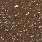 Immunohistochemical staining of human cerebral cortex shows strong positivity in neuropil.