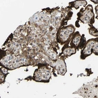 Immunohistochemical staining of human placenta shows strong cytoplasmic positivity in trophoblastic cells.