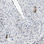Anti-ZP2 Antibody
