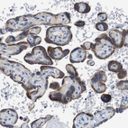 Immunohistochemical staining of human placenta shows strong granular cytoplasmic positivity in trophoblastic cells.