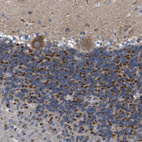 Immunohistochemical staining of human cerebellum shows strong granular cytoplasmic positivity in cells in granular layer.