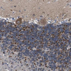 Immunohistochemical staining of human cerebellum shows strong granular cytoplasmic positivity in cells in granular layer.