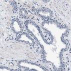 Immunohistochemical staining of human prostate shows no positivity in glandular cells as expected.
