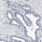 Immunohistochemical staining of human prostate shows no positivity in glandular cells as expected.