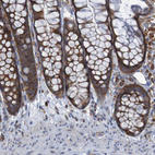 Anti-RPL10 Antibody